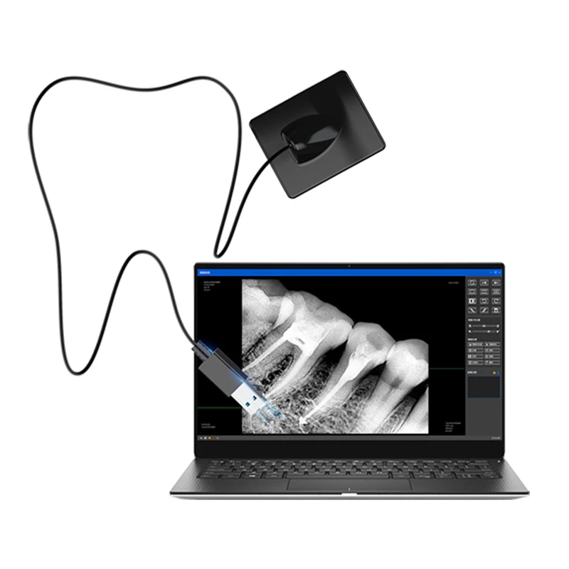 

New Type Hot Sale Equipment Portable Usb Digital Rvg X-ray Sensor For Clinic