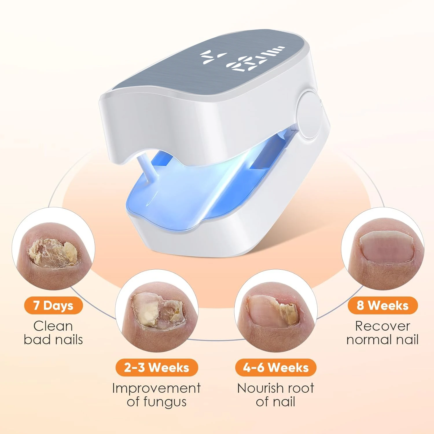 Nail Fungus Remover 1pcs Effective Rechargeable Nail Fungus Cleaning Laser Device Repair Damaged Discolored Thick Fingernails