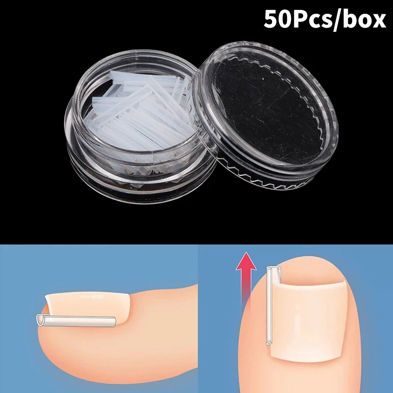 50pcs Ingrown Toenail Correction Tool Invisible Ingrown Toe Nail Treatment Pad Groove Straightening Clip Brace Foot Care Tool 3