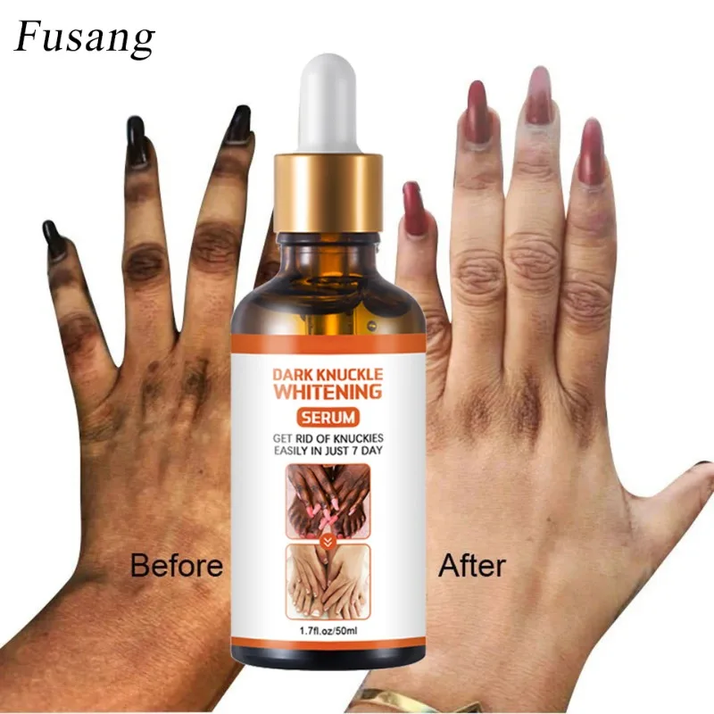Women Hand Knuckle Whitening Essence Elbows Knee Remove Melanin Serum Finger Joints Brightening Serum Whiten Dark Skin Products