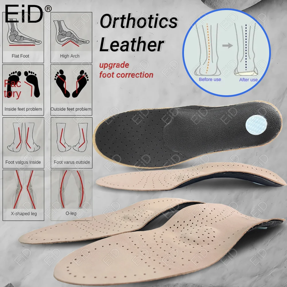 Best Insoles For High Arches