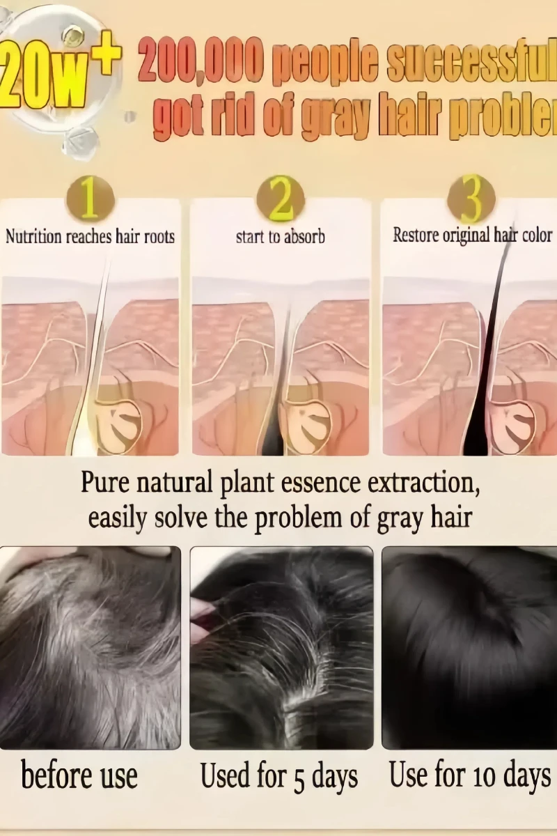 Hair Coloring Product White hair killer remove gray hair and restore natural color in 7 days hair coloring product