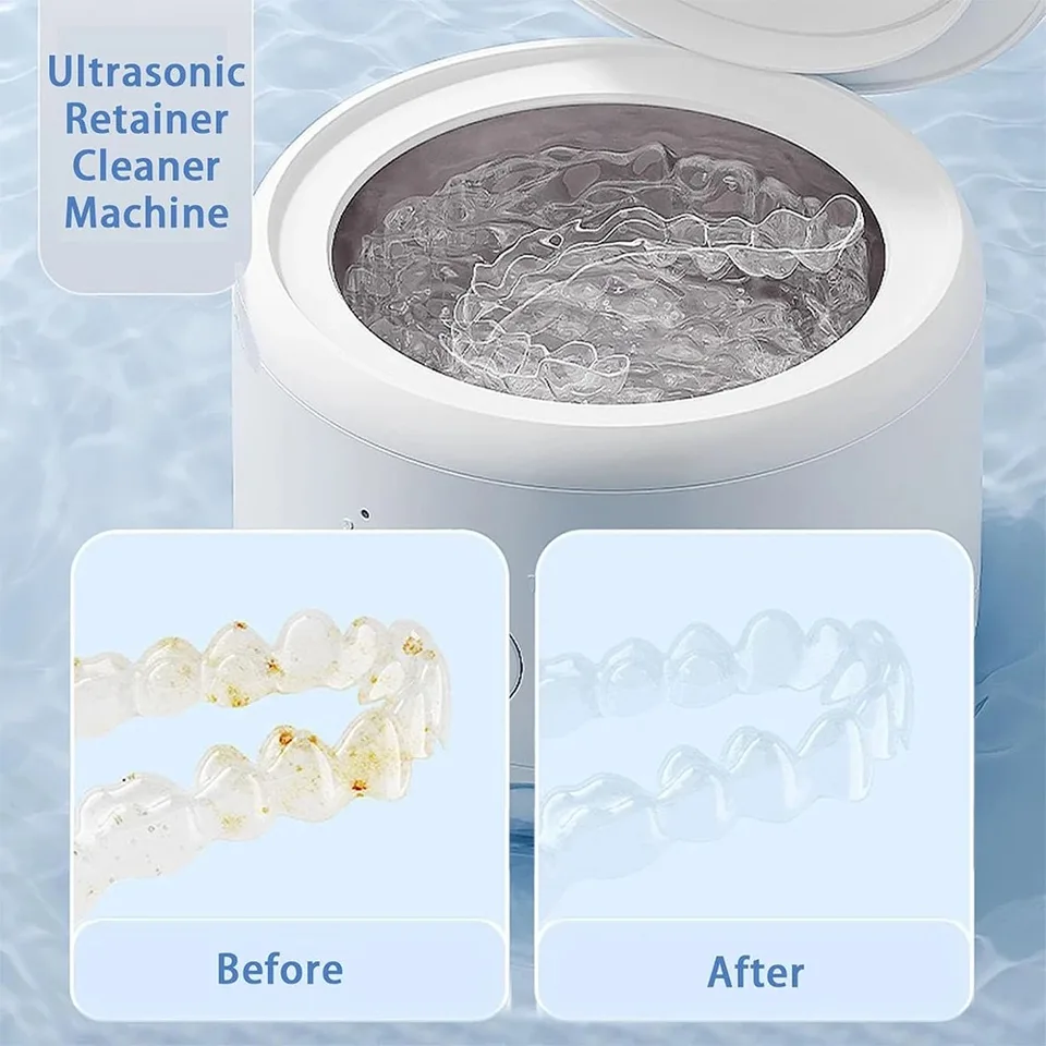 Ultrasonic Retainer Cleaner 48000Hz Retainer Cleaner Machine Portable Denture Cleaner Machine With 4 UV Lamps For Dentures, Night Guards, Sports Mouth Guards, Brackets, Aligners And - View #4