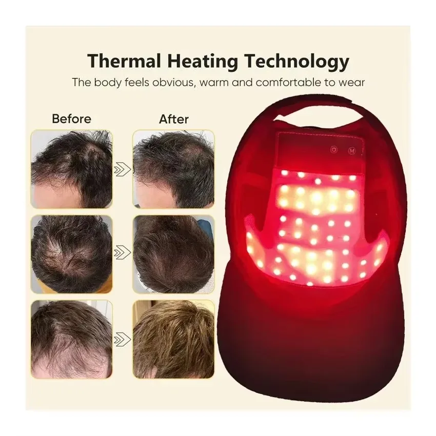 Red&Infrared Light Therapy Device For Hair Fast Growth Cap Red Light Therapy For Hair Loss Treatment With USB Charging Anti-hair