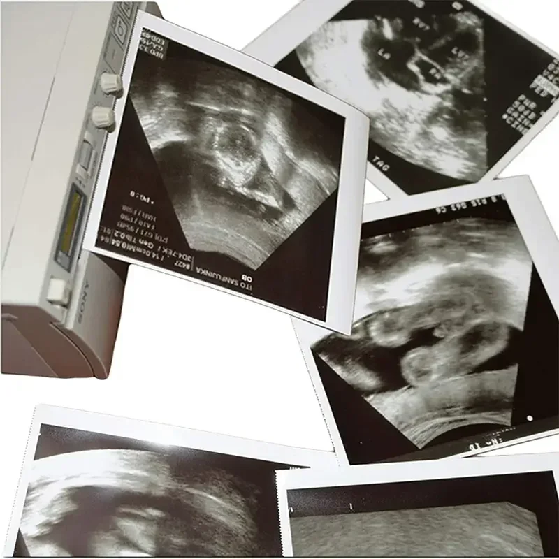  UP-890 UP-895MD UP-D895 UP-897MD UP-D897 호환 UPP-110HG 초음파 인쇄 용지, A6 사이즈, 흑백, 10 롤