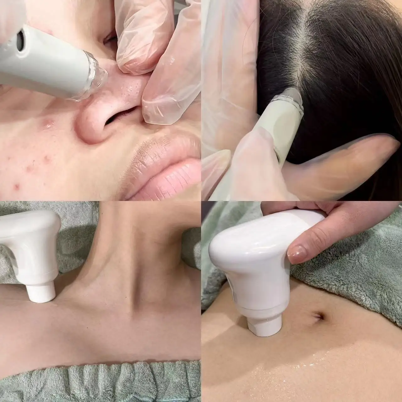 Water Dermabrasion Spa Facial Deep Cleaning Blackhead Removal Skin Care Microdermabrasion Oxygen Jet Hydralift EP Machine