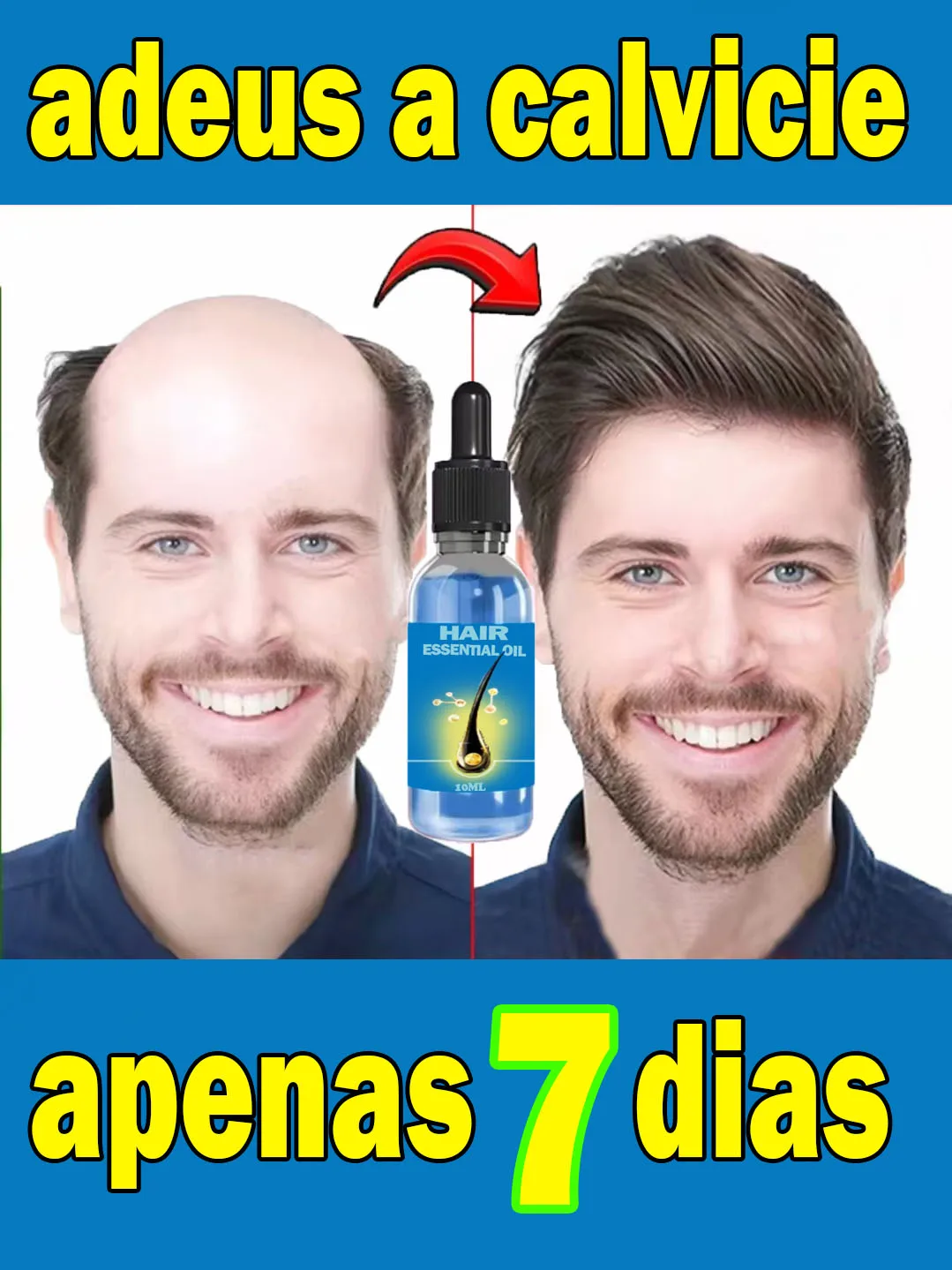 Produtos bem sucedidos,99% dos compradores comprar&atilde;o novamente,eles t&ecirc;m mais e mais cabelo, digamos calv&iacute;cie alfa, cabelo grosso