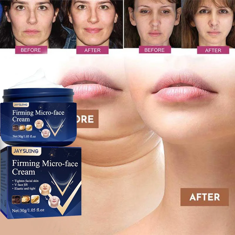 V-Shape Face Slimming Cream Lift Up V Double Chin Cheek Slimming ...