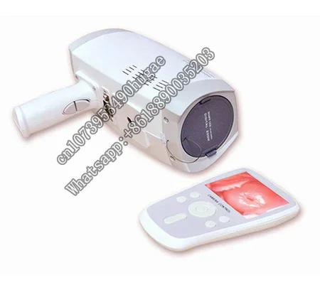 

Handheld Video For Gynecology
