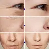 Retinol Wrinkle Remover Face Set Instant Firming Lifting Anti-Aging Serum Fade Fine Lines Whitening Korean Skin Care Products 3