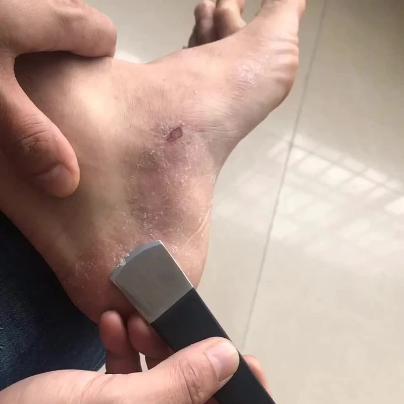 Рисунок 3 - инструменты для маникюра и пед