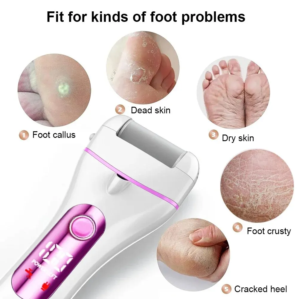 Electric Pedicure File Foot Dead Hard Skin Grinding Sandpaper for Heels Callus Remover Professional Feet Pedicure Care Tools Kit