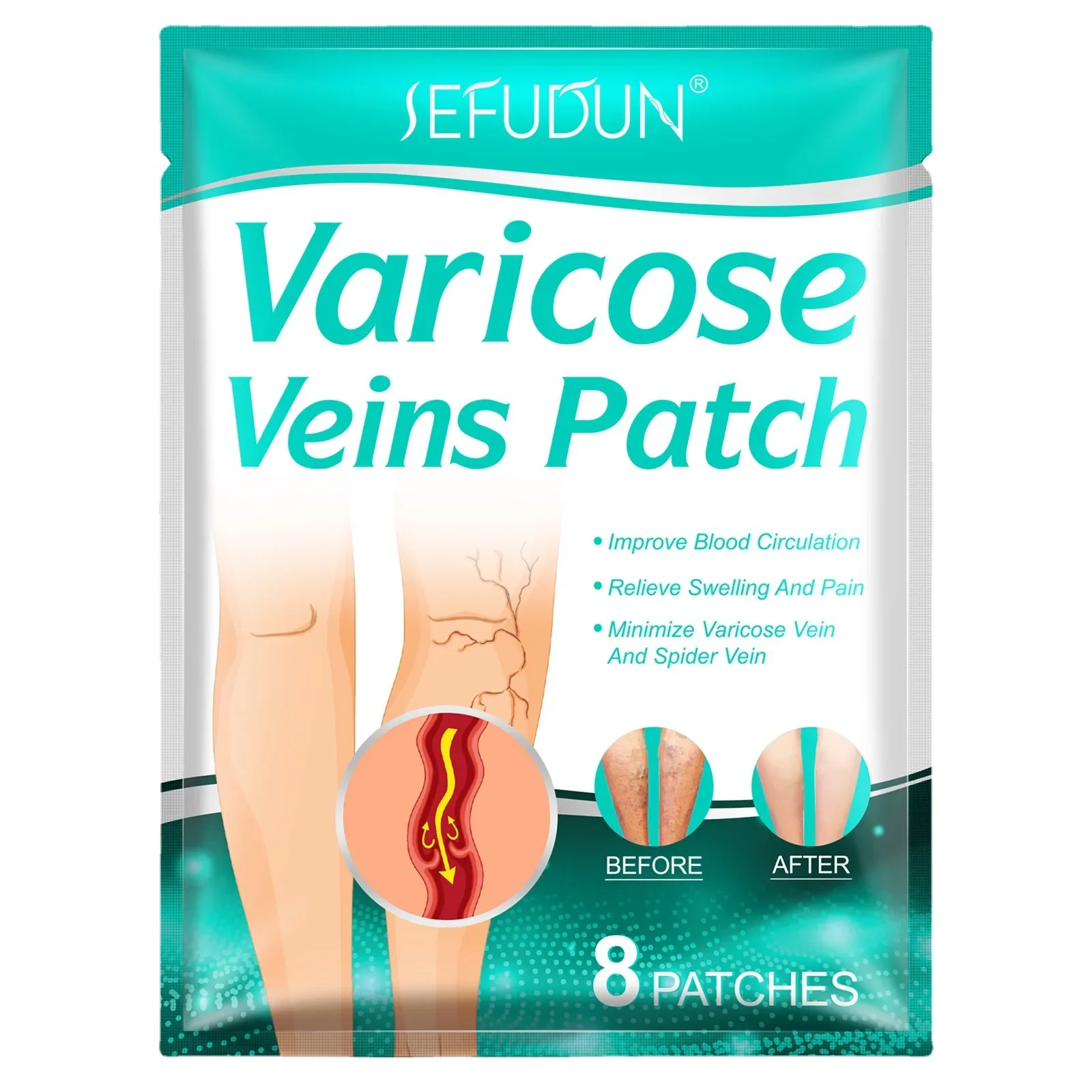8 PCS Varicose Veins Patch Treatment For Varicose Veins Vasculitis Phlebitis Spider Leg Medical Patch Angiitis Removal