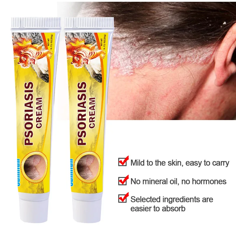 Sumifun ， Chinese Red Tiger, Psoriasis Cream, Skin Care Cream