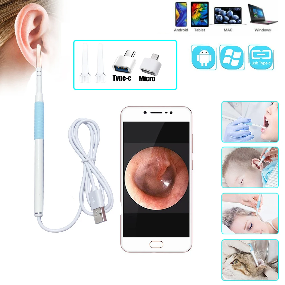 

HD In Ear Cleaning Endoscope Spoon Mini Camera Ear Picker Ear Wax Removal Visual Ear Mouth Nose Otoscope Support For Android PC