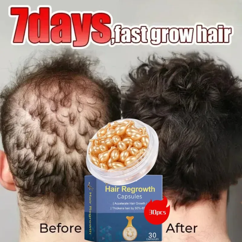 Hair Growth Serum 7 Days Fast Regrowth Essential Capsule Anti Hair loss Baldness Repair Damaged Scalp Treatment For Women Men