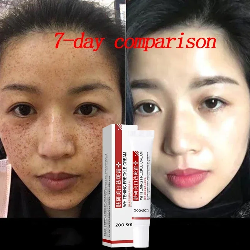 

Face Melasma Cream Brightening Dark Skin Remove Black Dots Lightening Melanin Brighten Cream For Dull Skin Moisturizing Product