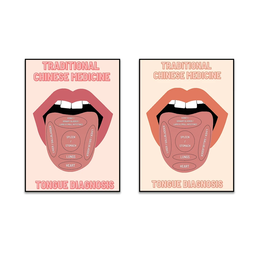Traditional Chinese Medicine Tongue Chart