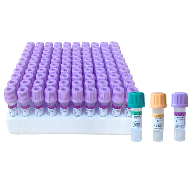 Labor-Vakuum-Blutentnahmeröhrchen EDTAK2-Röhrchen Blutentnahmeröhrchen Probenahmeröhrchen Lehrmittel 2ML 3ML 5ML 10ML 100 Stück – Detail 10