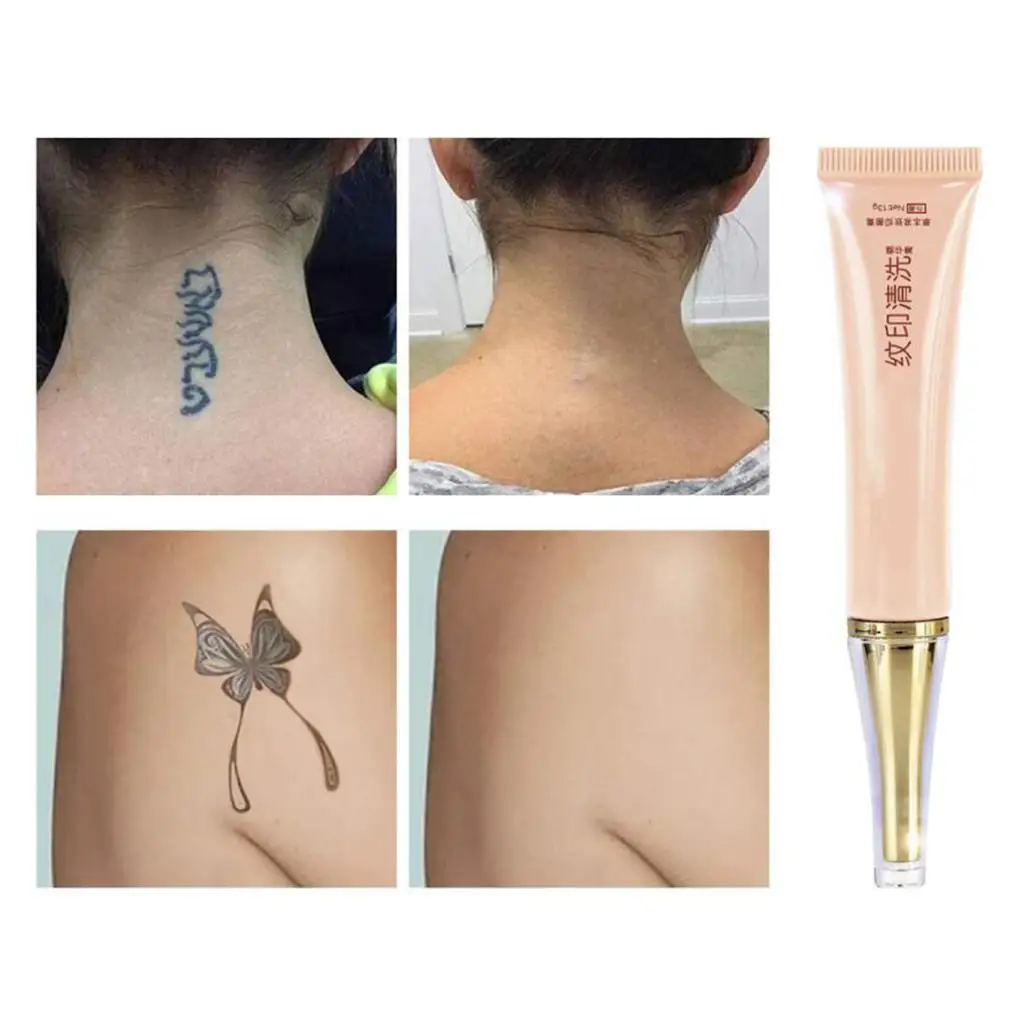 

Magideal оцинкованная пенисанская оправа, макси