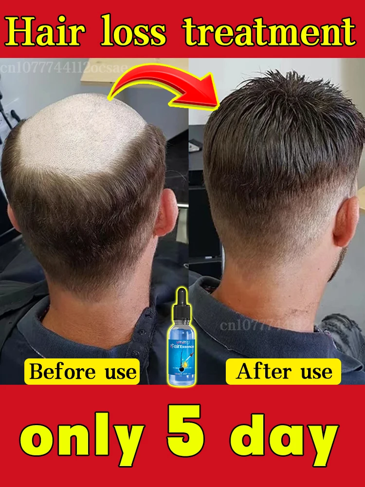 Product Grow Thick Hair hair growth serum,hair building powder,hair building fibers,hair growth spray,hair growth cream,hair growth shampoo set