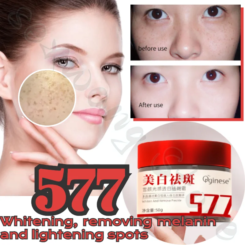 Whitening and Translucent Freckle Removal Cream Dilutes Various Stubborn Spots and Inhibits Melanin 577 Freckle Removal Cream