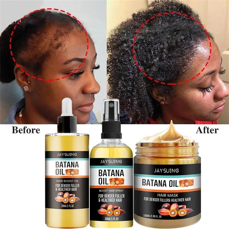 Fast Hair Growth Oil Africa Crazy Traction Treatment Hair Loss Spray Hair Regrowth Powerful Hair Root Repair Hair Mask Hair Care