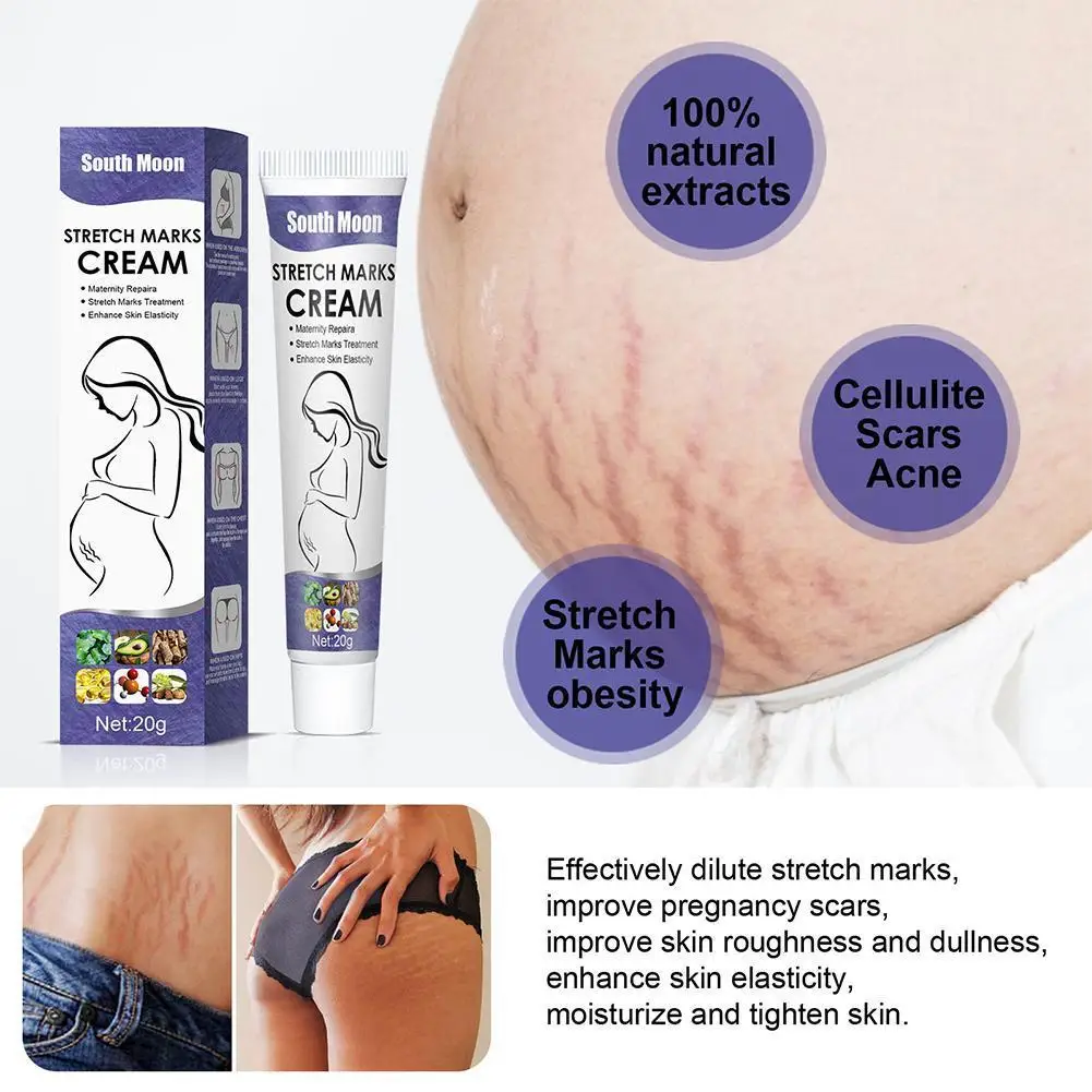 

Remove Pregnancy Scars Acne Cream Stretch Marks Treatment Maternity Repair Anti-Aging Anti-Winkles Firming Body Creams