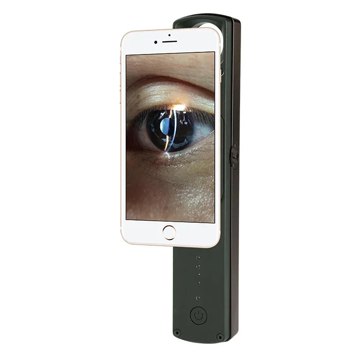 S150D China ophthalmic 6X Portable digital veterinary human slit lamp with APP with mobile adaptor