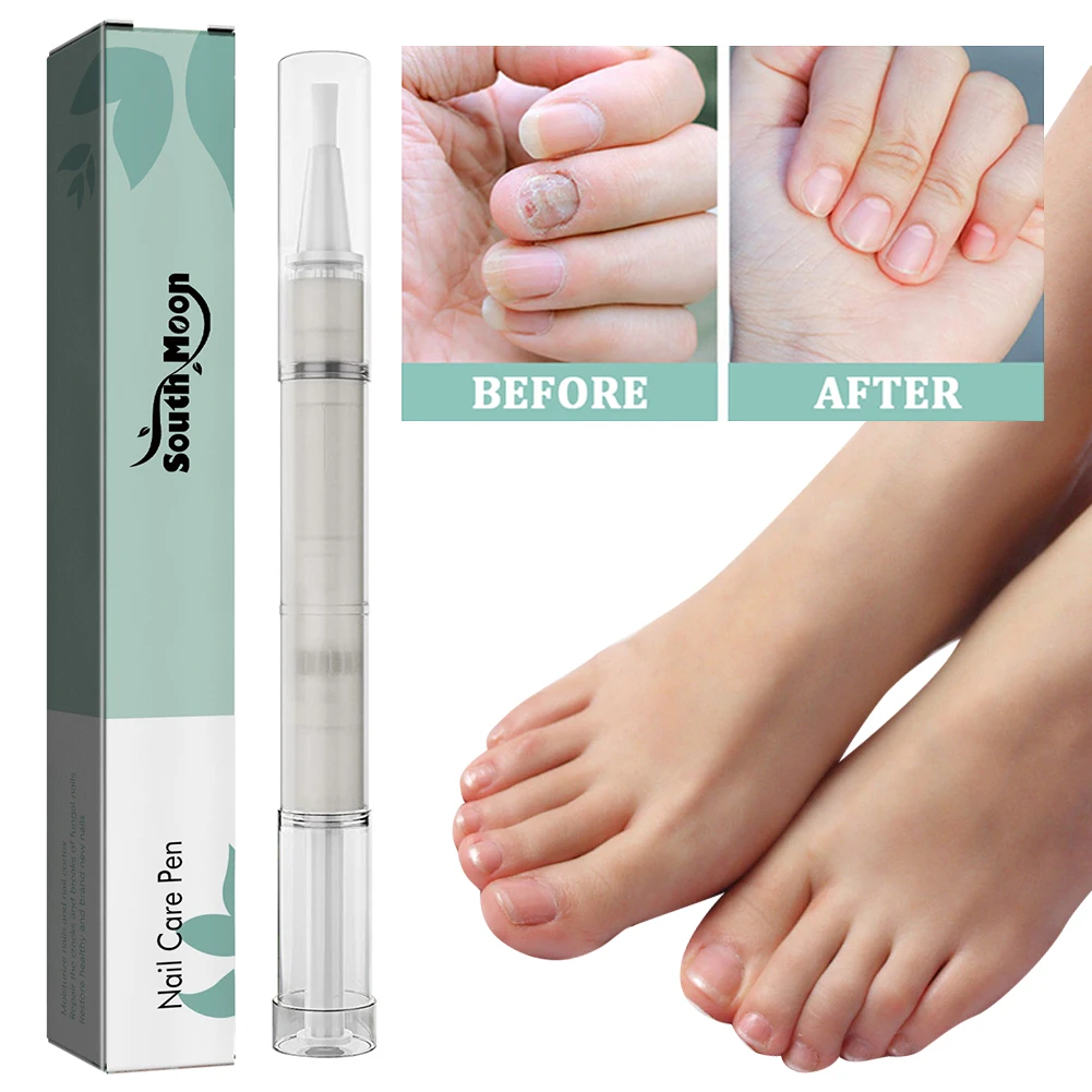 Nail Care Pen 4ml Toenail Repair Pen with Natural Ingredients Cuticle Oils Moisturizing for Restoring Healthy Strong Nails nail care oil nail strengthener nail cuticle oil pen