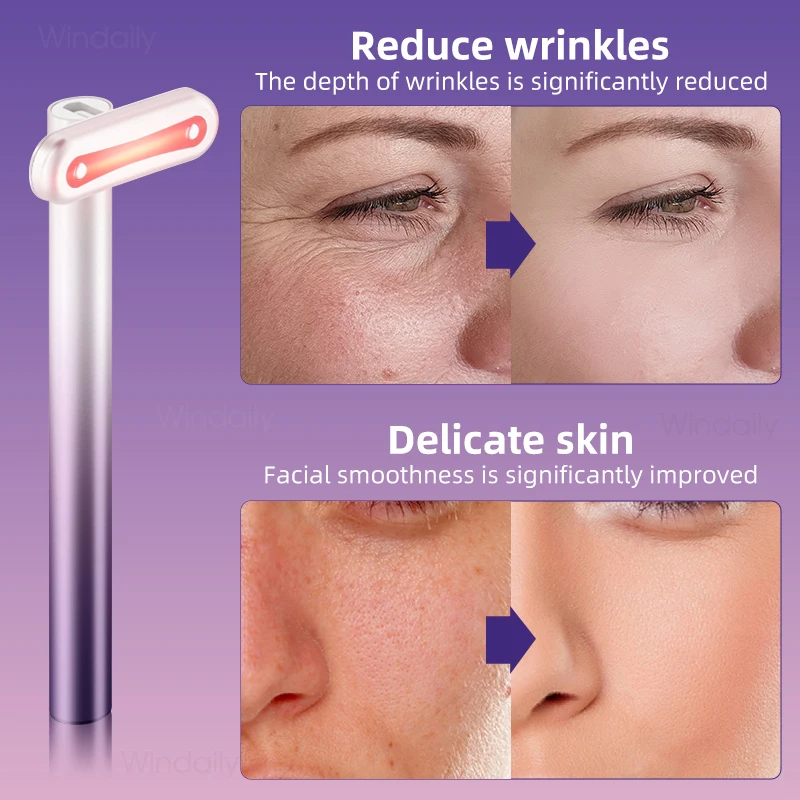 4-in-1-Gesichtsstab, EMS-Mikrostrom-Vibration, warmes rotes Licht, Gesichtsstraffung, Gerät zur Hautstraffung, Hals und Auge_voghion.com