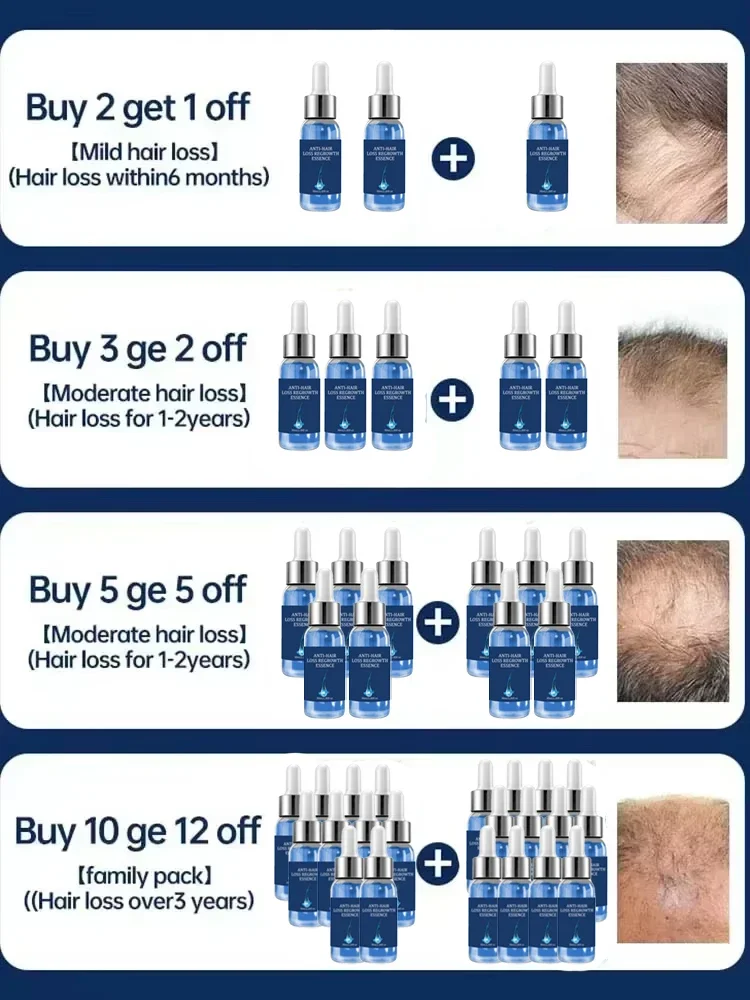 Hair Growth Serum Fast Hair Growth Oil Effective Baldness Repair Hereditary Hair Loss Postpartum Loss Seborrheic