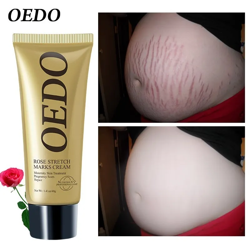 

Rose Remove Stretch Marks Cream Anti Wrinkle Anti Aging Maternity Skin Repair Remove Pregnancy Scars Treatment Body Skin Care