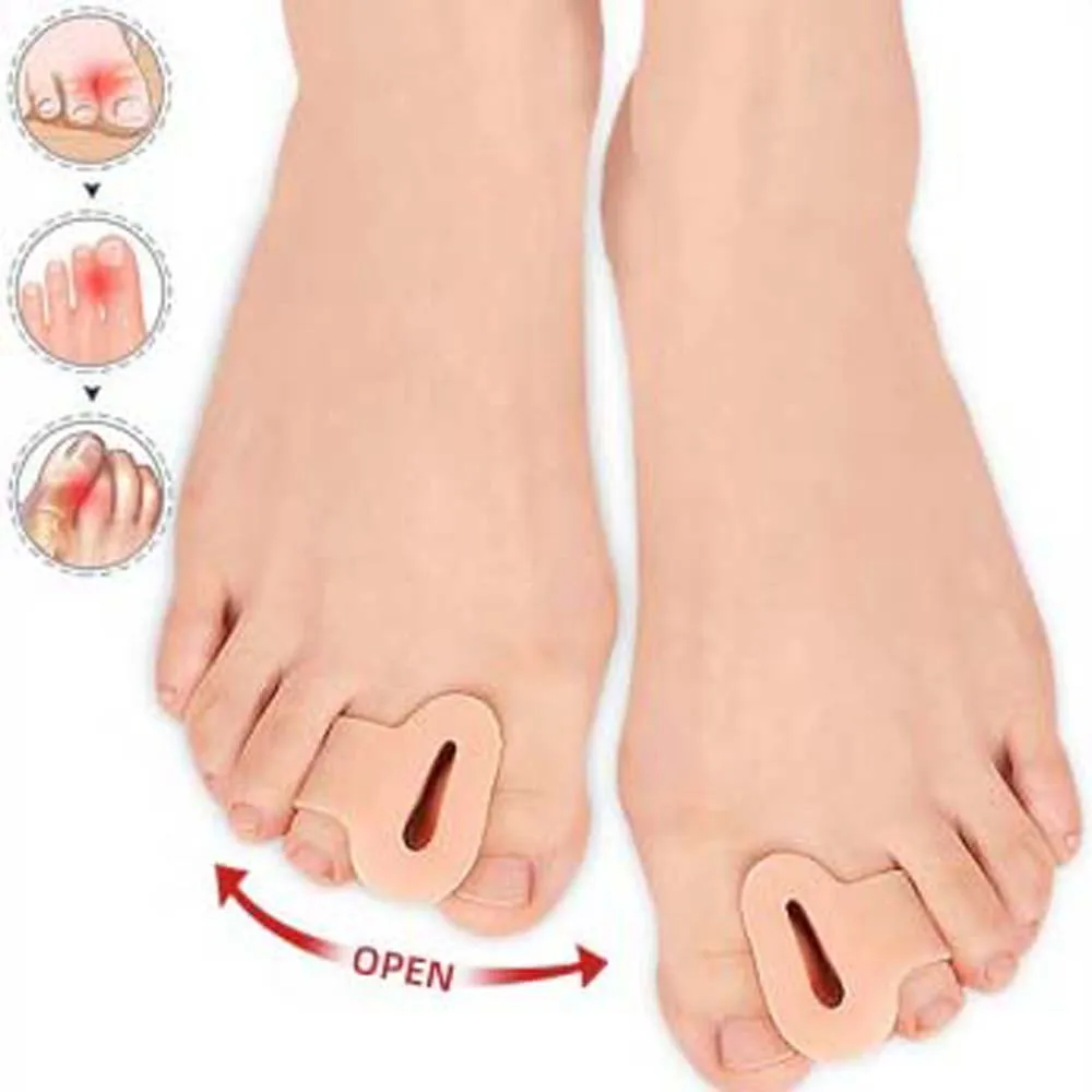 

Therapy Big Toe Valgus Toe Straightener Thumb Eversion Correction Reduce Pressure Prevent Toe Splint Separator SEBS