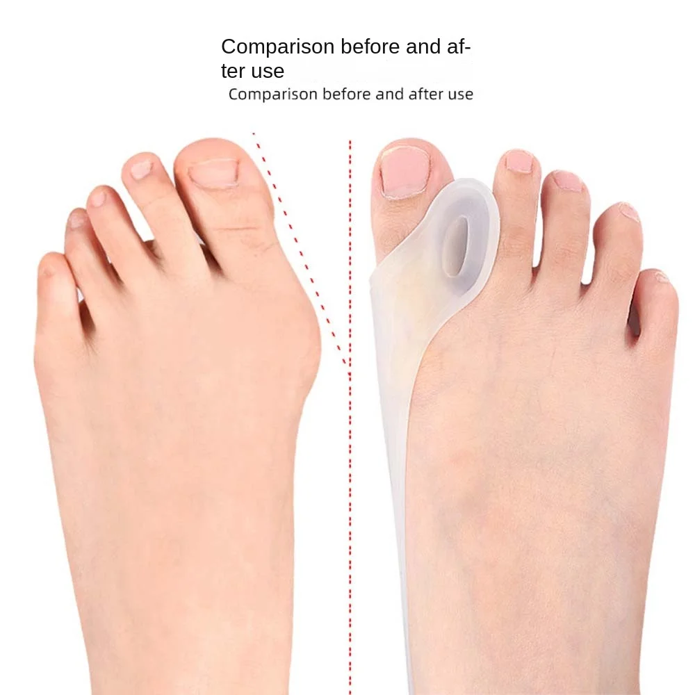 Thumb Valgus Adjuster Toe Straightener Bunion Protector Feet Valgus Corrector Toe Separators Foot Care Tools SEBS