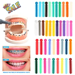40Sticks / Pack Dental Orthodontic Elastic Ligature Ties  for Brackets Braces 2.5*0.48 Colorful Dentist Orthodontics Treatment