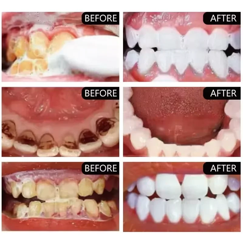 Teeth Whitening Powder Remove Plaque Stains Oral Hygiene Bleaching Dental Tools Tooth Care