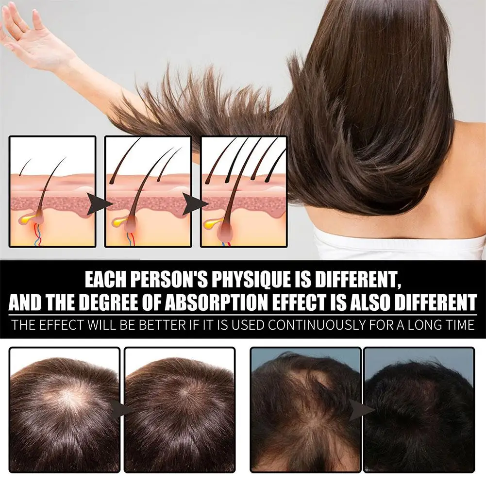 Nutrition Biotin Liquid Drops Hair Growth Essential Oil Collagen B7 Vitamin Oil Trengthen Hair Root Anti Loss Treatment hair essence oil,hair growth oil,hair oil
