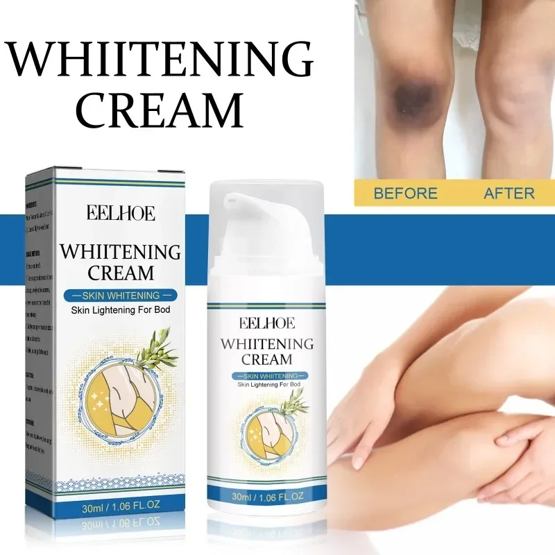 Skin whitening cream armpit Knee Neck removal dark Spots Melanin Bleaching Underarm Inner Thigh brighten moisturizing body care
