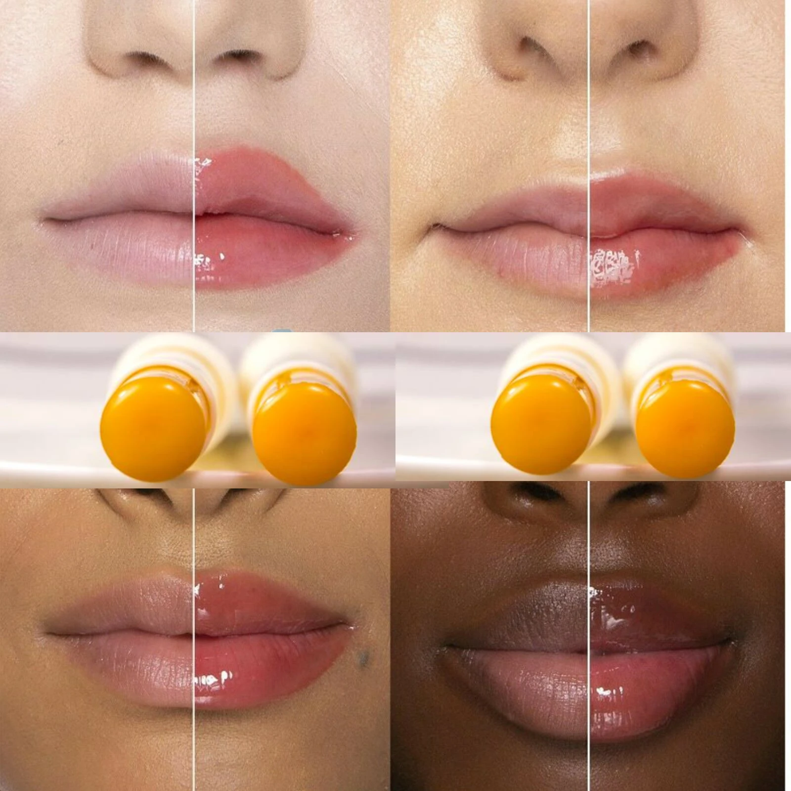 입술 플럼 퍼 인핸서 밤 피부 농축기 바늘 수분 공급, 영양, 브라이트닝, 립 플럼 퍼 