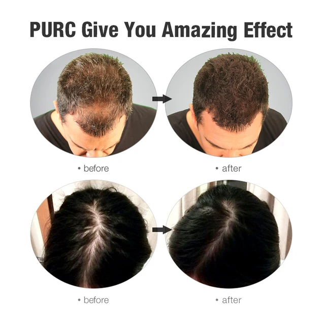 PURC Fast Hair Growth Shampoo Conditioner Thickener Anti Loss Hair Grow Shampoo Set