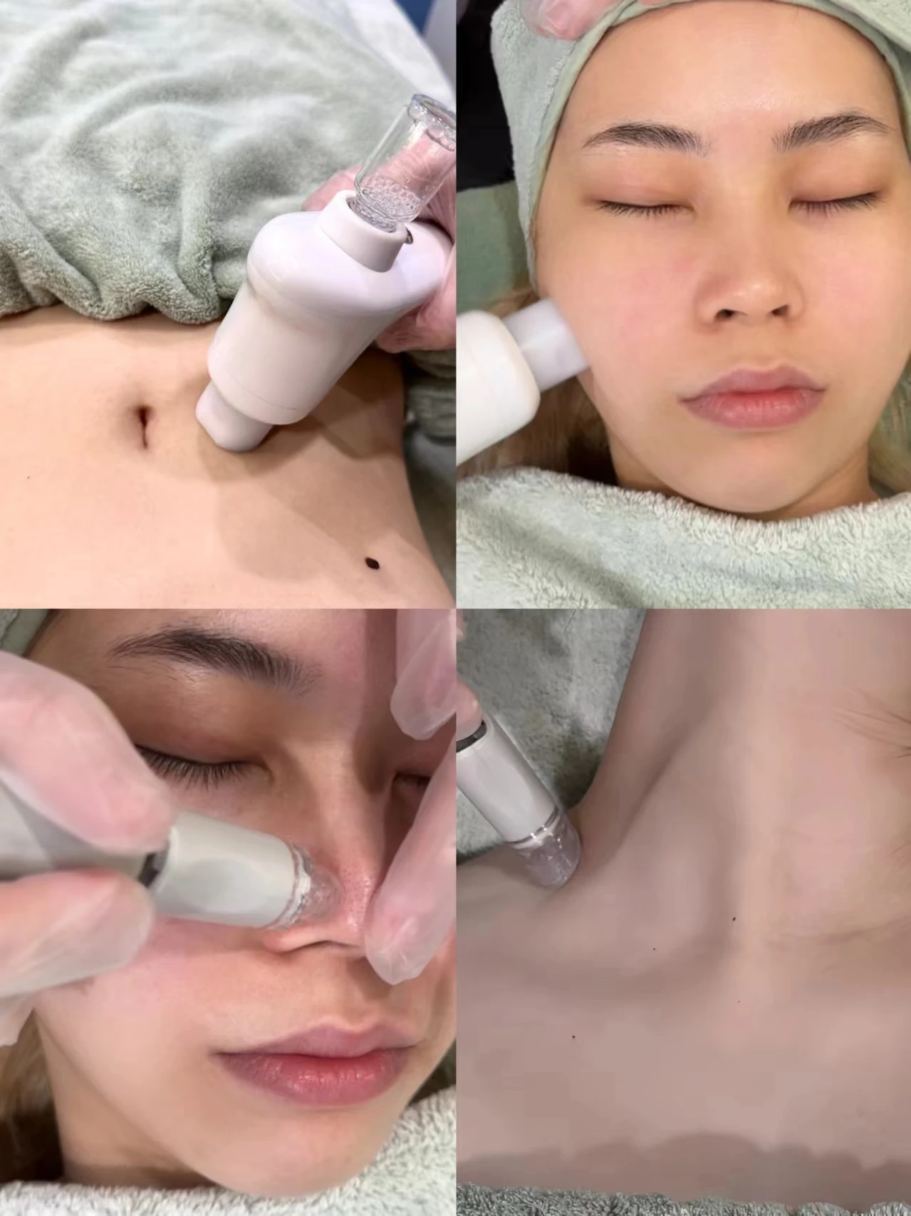 Facial Cleansing tips Face Lift Hydralift Ep Machine Hydrotherapy Machine