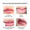 Lip Collagen Soothing and Moisturizing Delicate Lips To Prevent Cracking Freezing Exfoliation Day Night Repair Lip Care Products 4