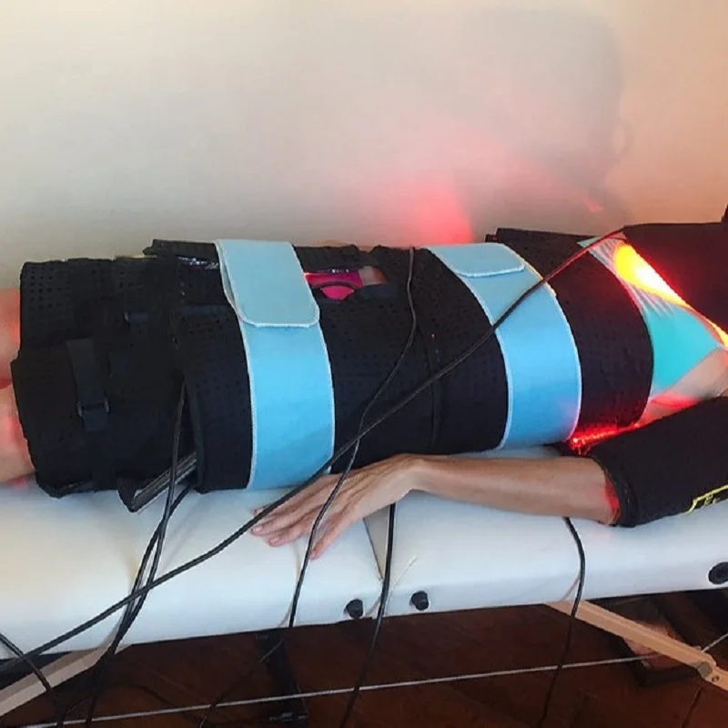 lipolysis laser