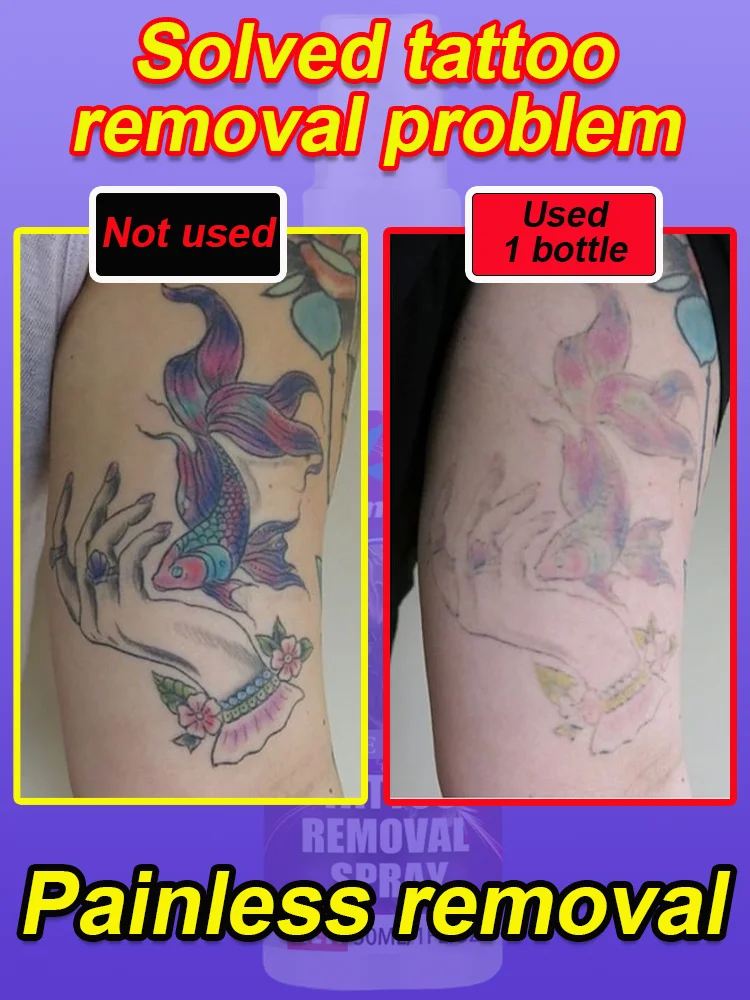 Fast tattoo removal, tattoo black color easy to use permanent tattoo removal