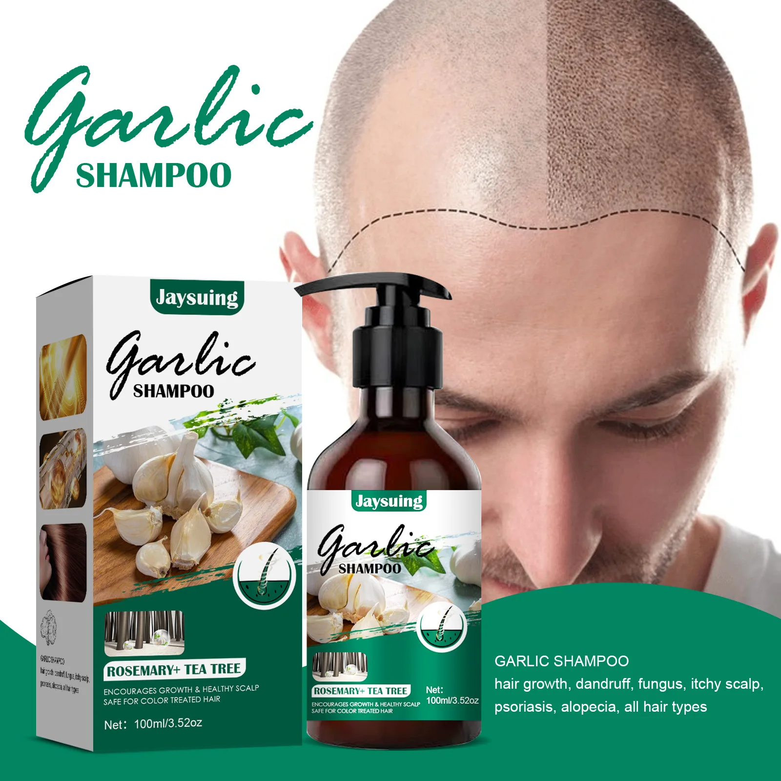 Garlic Shampoo Itchy Relief Shampoo Growth Anti Fallout Hair Growth For All Types _ - AliExpress Mobile