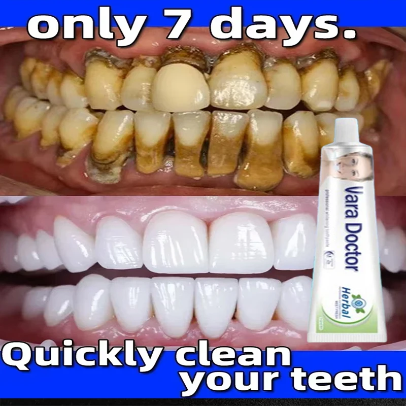 Whitening Teeth Remover Dental Calculus Mouth Odor Removal Bad Breath Preventing Periodontitis Remove Oral Stains Tooth Care