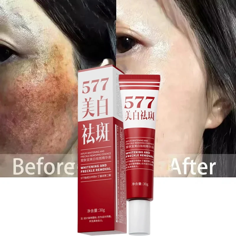 Fades Freckle Dark Spots Face Cream Niacinamide Whitening Cream Vitamin E Improve Dullness Fast Brighten Nourish Skin Care whitening body cream niacinamide serum facial cream