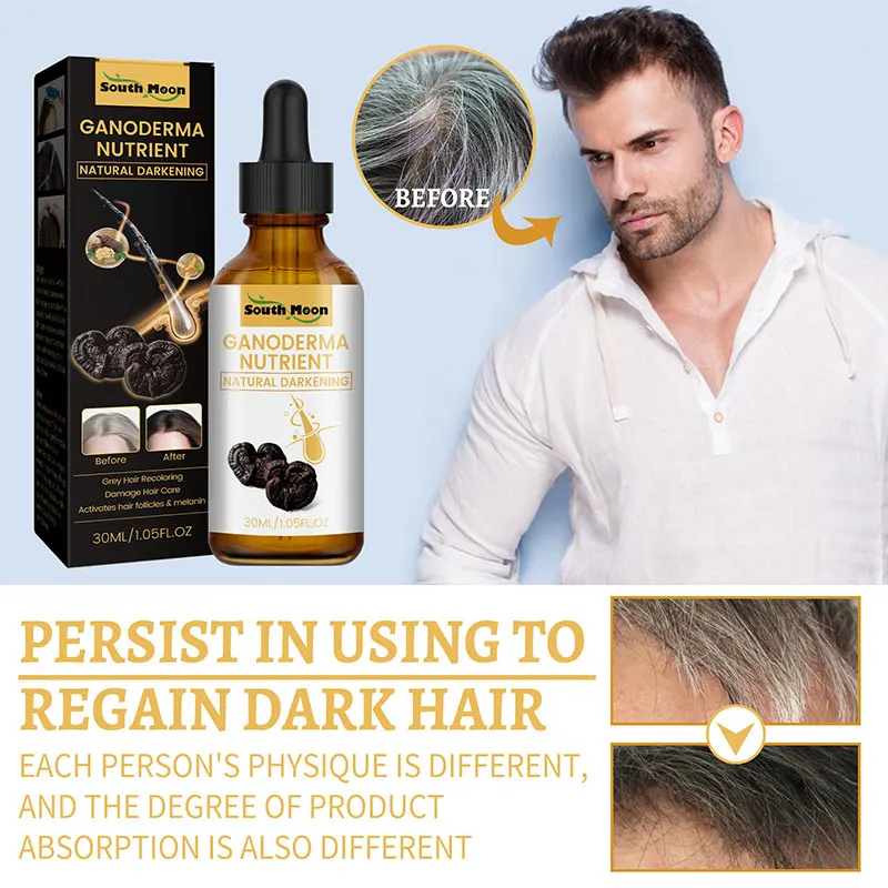 Top more than 163 food to prevent white hair ceg.edu.vn
