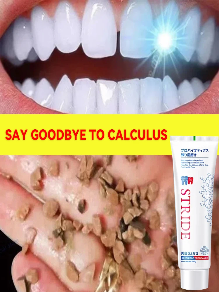 

Dental Calculus Remover Whitening Teeth Toothpaste Brightening Preventing Periodontitis Removal Bad Breath Dental Cleansing Care